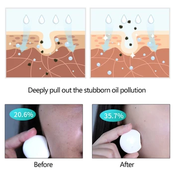Strokovno Sonic Vibracije Električni Obrazno Čistilno Krtačo Globoko Obraz Pranje Por Čistilo Za Obraz Massager Nego Kože Orodje